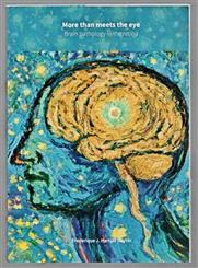 More than meets the eye : brain pathology in the retina